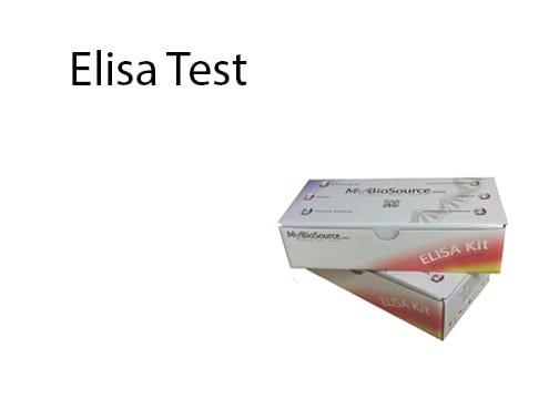 Elisa Test